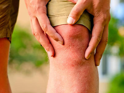Боль в колене при ходьбе, сгибании и разгибании: причины и лечение