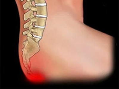 Боль в области крестца и поясницы может быть симптомом поражения внутренних органов!